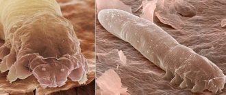 photo demodex