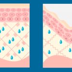 Hyaluronic acid for facial skin