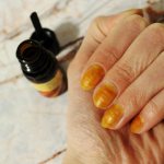 iodine for nails