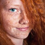 How to get rid of freckles at home