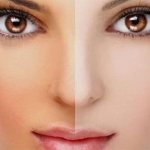 Как осветлить кожу лица после загара