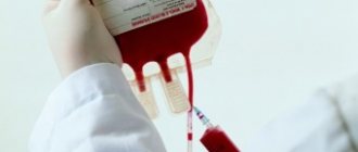 How does a blood transfusion work for acne?