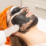 Carbon facial peeling