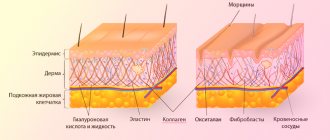 Collagen in skin