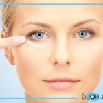 Correction of wrinkles around the eyes