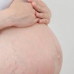 Лечение атопического дерматита при беременности