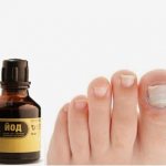 Treatment of nail fungus with peroxide and iodine