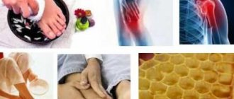 Honey with salt for joints. Salt with honey will help sore joints or wedge by wedge 