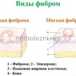 Main types of formations