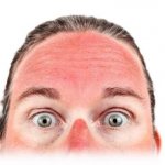 redness of the facial skin