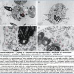 Rice. 1. Electron microscopy of sperm. A – longitudinal section of a sperm with capsids of viruses (VV) of the herpes group. B – cross section through the middle section of the sperm flagellum. C – fragment of the middle section of the sperm flagellum. Viral capsids 