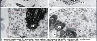 Rice. 1. Electron microscopy of sperm. A – longitudinal section of a sperm with capsids of viruses (VV) of the herpes group. B – cross section through the middle section of the sperm flagellum. C – fragment of the middle section of the sperm flagellum. Viral capsids 