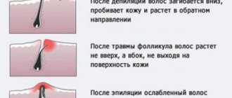 Шугаринг бикини глубокое, классическое. Видео, как правильно делать в домашних условиях для интимной зоны. Фото до и после