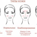 Типы кожи