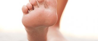 Removal of plantar warts