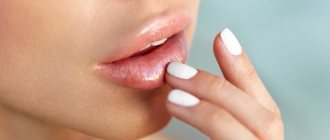 Lip care after augmentation