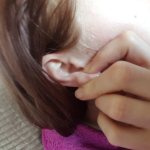уплотнение в мочке уха прокол