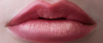 Lip augmentation