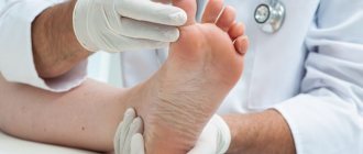 Вальгусная деформация пальца стопы: особенности развития и лечения патологии