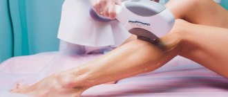 Harm from laser hair removal to humans